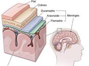 Meningitis, síntomas