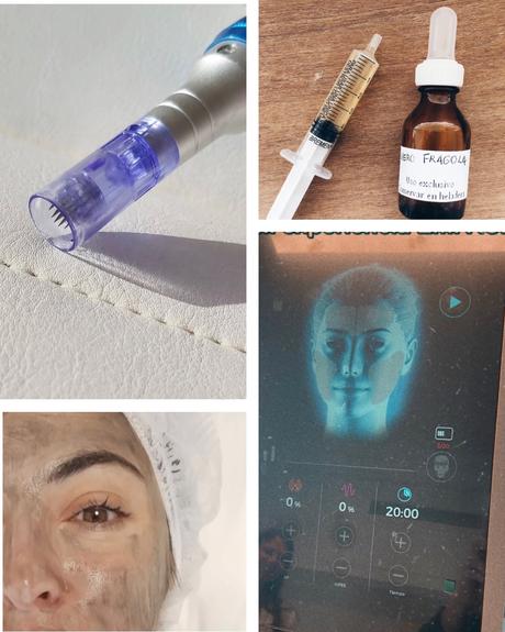 Tratamientos faciales Boda casamiento Argentina precio lifting