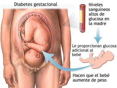 Impacto de la diabetes materna en la morbimortalidad de lactantes prematuros