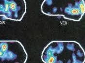 estudios actividad cerebral menos fiables previsto