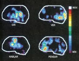 Los estudios de actividad cerebral son menos fiables de lo previsto