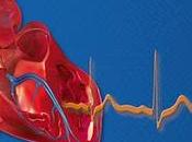 Mortalidad implementación óptima estrategias terapéuticas para insuficiencia cardíaca