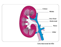 El trasplante de riñón, la cirugía