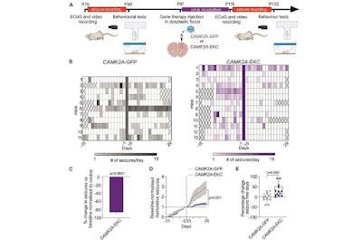 Nueva terapia para la epilepsia infantil