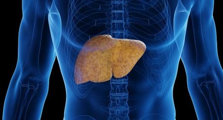 Claves para la prevención y tratamiento de la enfermedad del hígado graso, según un estudio prevencion higado graso