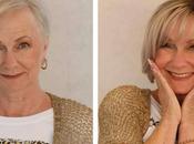 Microlíneas, prótesis capilar indetectable Fermín Peluqueros para mujeres alopecia cabello fino
