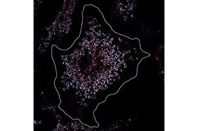 Identifican el mecanismo que desencadena el lupus en niños Identifican el mecanismo que desencadena el lupus en niños