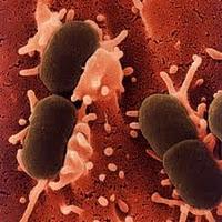 La Bacteria Sutterella Afecta el Intestino de los Autistas