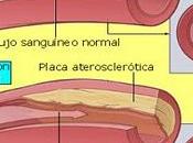 Riesgo cardiovascular, función endotelial, hipertrigliceridemia