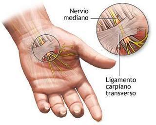 cuidar-muneca cuidar muneca Aprende a curar tu muñeca
