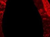 Alzheimer, Parkinson… Nueva pista contra enfermedades