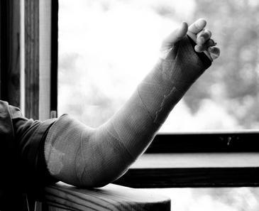 Llevar cabestrillo provoca cambios en el cerebro