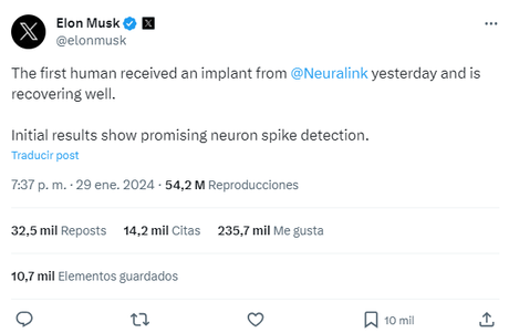 Neuralink: los chips cerebrales de Elon Musk desafían el futuro