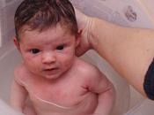Consejos para cuidar piel átopica bebé
