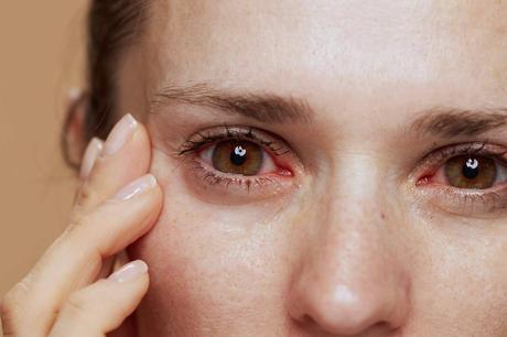La solución perfecta para combatir el ojo seco La solución perfecta para combatir el ojo seco