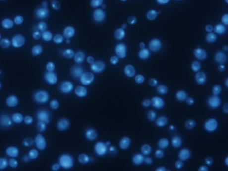 Cómo cuantificar cualquier biomolécula que contenga azufre