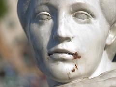 Antecedentes de la cirugía de cataratas