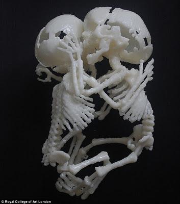 El acabose: figuritas de la ecografía en 3D de tu hijo