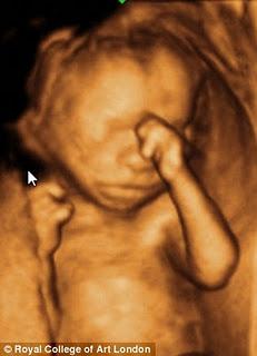 El acabose: figuritas de la ecografía en 3D de tu hijo