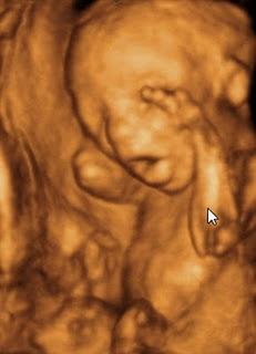 El acabose: figuritas de la ecografía en 3D de tu hijo