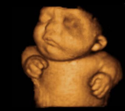 El acabose: figuritas de la ecografía en 3D de tu hijo