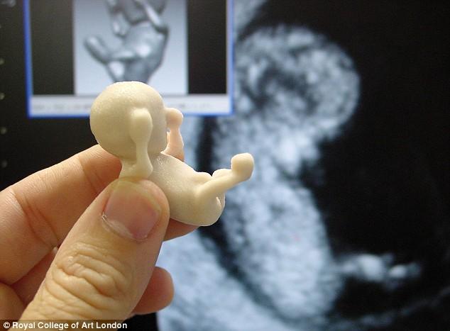 El acabose: figuritas de la ecografía en 3D de tu hijo