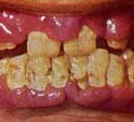 Verdades en la nutrición del perro (5).  Una lección de la historia