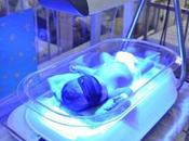 Firefly, fototerapia para recién nacidos