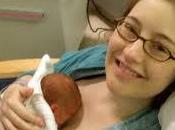 consiste método canguro