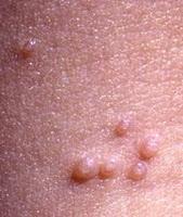 Moluscos que no son para comer