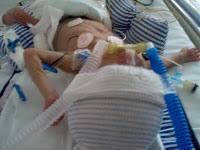 'Nuestros Prematuros, mucho más que estrellas de cine'