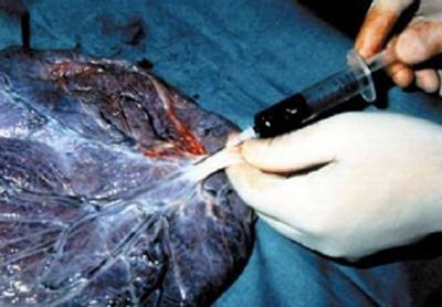 celuloterapia celuloterapia ¿En que consiste la Celuloterapia?