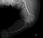Identifican nuevo responsable osteogénesis imperfecta
