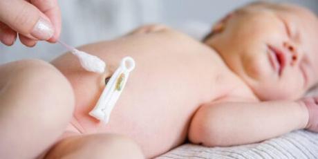 Cómo cuidar el cordón umbilical de tu bebé tras el hospital