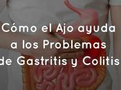 Cómo ayuda Problemas Gastritis Colitis