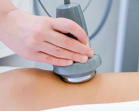 Alternativas No Quirúrgicas para Moldear tu Cuerpo