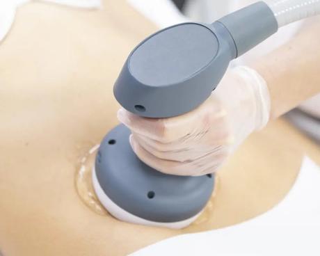 Alternativas No Quirúrgicas para Moldear tu Cuerpo