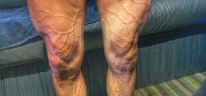 Entendiendo la Potencia Crítica en Ciclismo