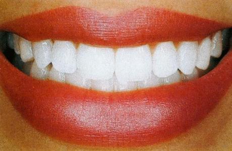 DENTADURA DE CABALLO Un 'blanco nuclear' y una dentadura impoluta: Esto es lo que nos venden, nada más lejos de la realidad.