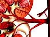 Estrategias tratamiento niños nefropatía asociada síndrome urémico hemolítico