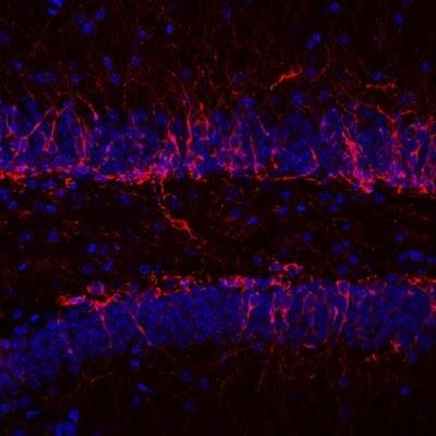 Un estudio de la UAM demuestra cómo ciertas mutaciones en una proteína inducen a la depresión