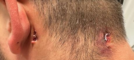 No vemos heridas por arma de fuego, en nuestro centro de ...