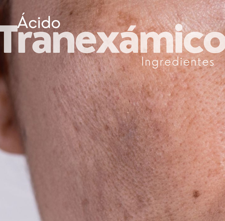 Marcas productos precio melasma