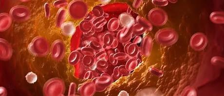 Vacuna AstraZeneca – Efectos secundarios de síndrome de trombosis