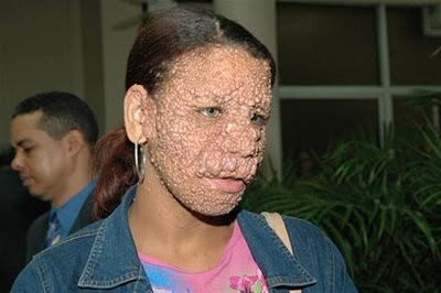 Mujer que padece extraña enfermedad