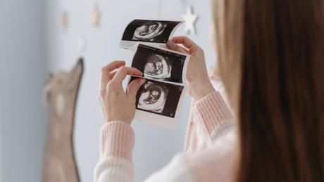 ¿Prueba de embarazo positiva? Descubre qué significa y cómo confirmarlo definitivamente