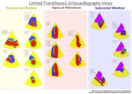 Introducción a la ecografía en Atención Primaria. Introduction to Primary Care Ultrasound. 初级保健超声波简介 Introducción a la ecografía en Atención Primaria. Introduction to Primary Care Ultrasound. 初级保健超声波简介