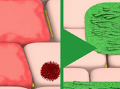 Kijimea Colon Irritable Pro: opiniones análisis completo (2024)