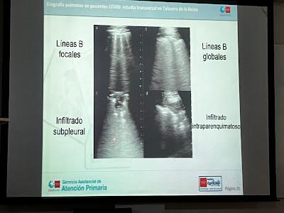 Ecografía para novatos.     Ultrasound for beginners.     超声波初学者