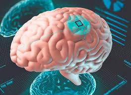 Mediante un implante cerebral y el uso de IA restablecen el habla Mediante un implante cerebral y el uso de IA restablecen el habla